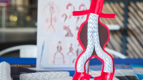 Modell einer Stent-Prothese innerhalb der Aorta (Quelle: Getty Images/Pitchayanan Kongkaew) Das Modell einer Stent-Prothese innerhalb der menschlichen Aorta steht auf dem Tisch einer Arztpraxis.