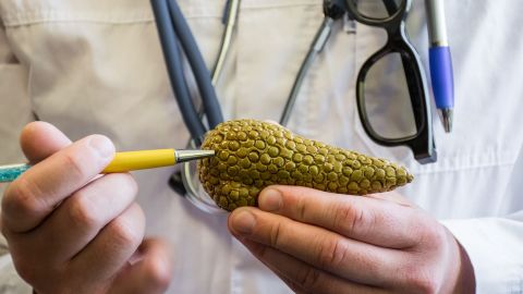 Modell einer Bauchspeicheldrüse (Quelle: Getty Images/Shidlovski) Pankreatitis: Ein Mann im Laborkittel hält einen Kugelschreiber in der Hand. Mit dessen Spitze zeigt der Mann auf ein anatomisches Modell der menschlichen Bauchspeicheldrüse, das er in der anderen Hand hält.