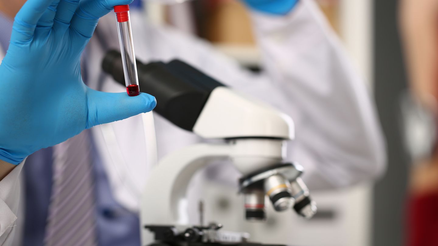 Blutprobe (Quelle: Getty Images/Ivan-balvan) Hämophilie: Eine Hand in blauen Medizinhandschuhen hält ein Röhrchen, in dem eine Blutprobe ist. Im Hintergrund ein Mikroskop.