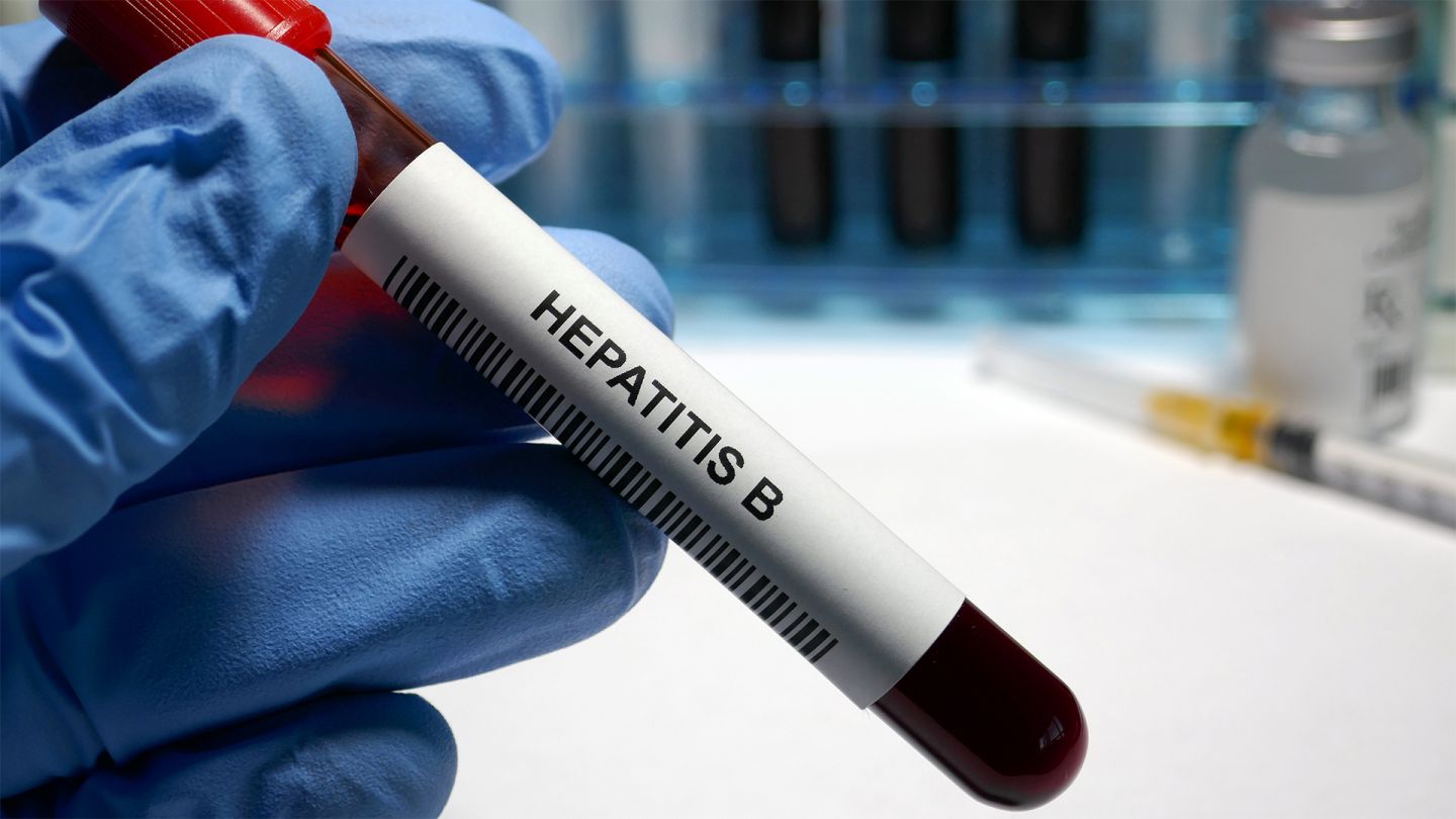 Hepatitis B (Quelle: Getty Images/Hailshadow) Eine Hand mit einem blauen Schutzhandschuh hält ein Blutteströhrchen, welches mit einem Aufkleber bedruckt ist, auf dem die Aufschrift Hepatitis-B steht.