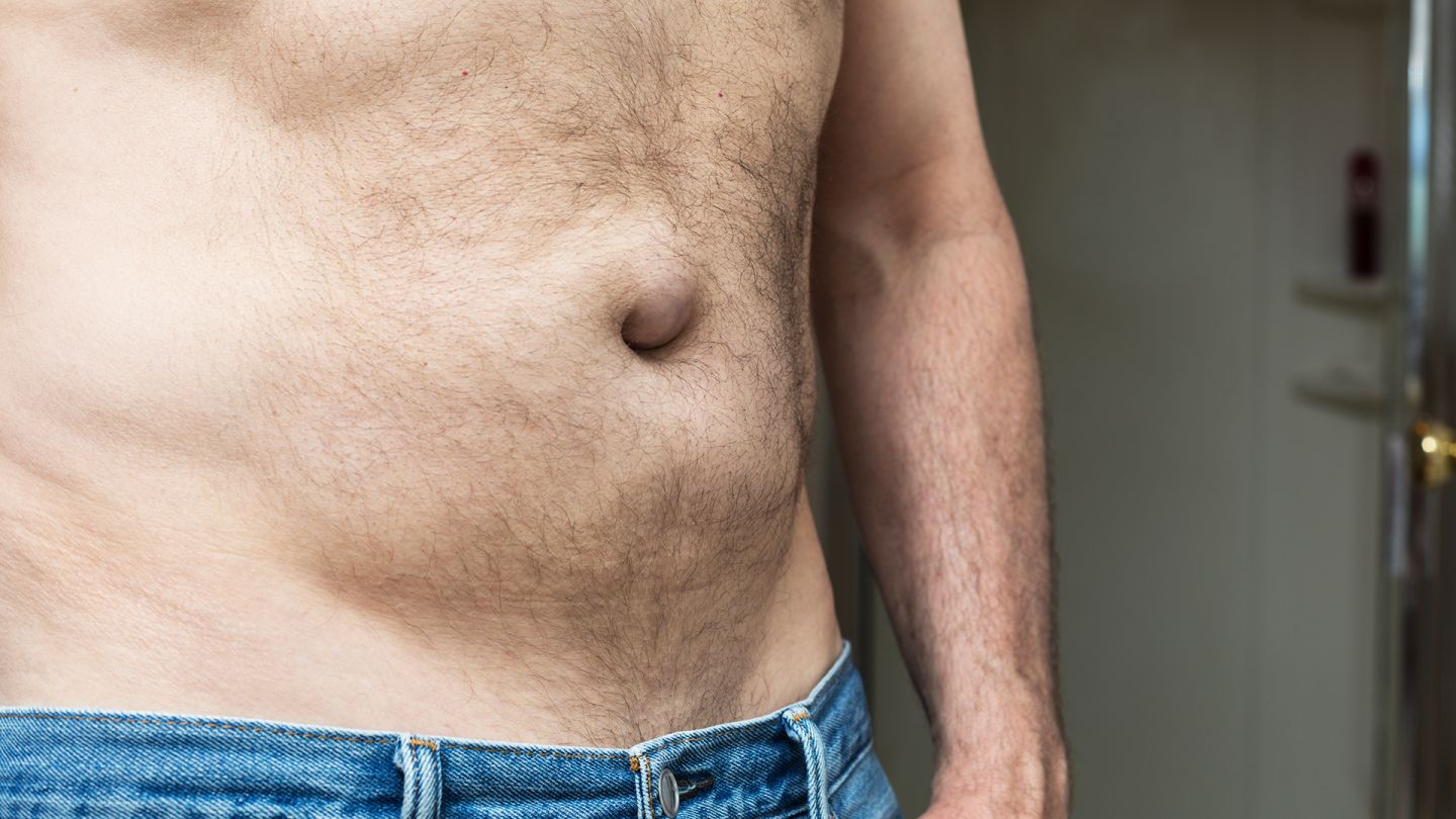 Bauch eines Mannes (Quelle: Getty Images/Willowpix) Hernien (Leistenbruch): Ein Mann zeigt seinen freien Oberkörper und Bauch.