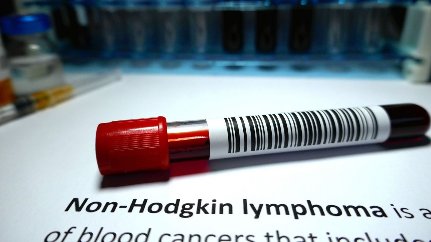 Blutprobe (Quelle: Getty Images/Hailshadow) Non-Hodgkin-Lymphom: Auf einem weißen Untergrund liegt eine Blutprobe, die mit einem Barcode versehen ist.