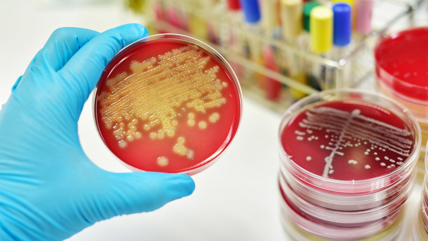 Sepsis (iStock/jarun011) Eine behandschuhte Hand hält eine Petrischale, in der Bakterienkulturen zu sehen sind. Auf dem Tisch daneben stehen weitere Petrischalen.