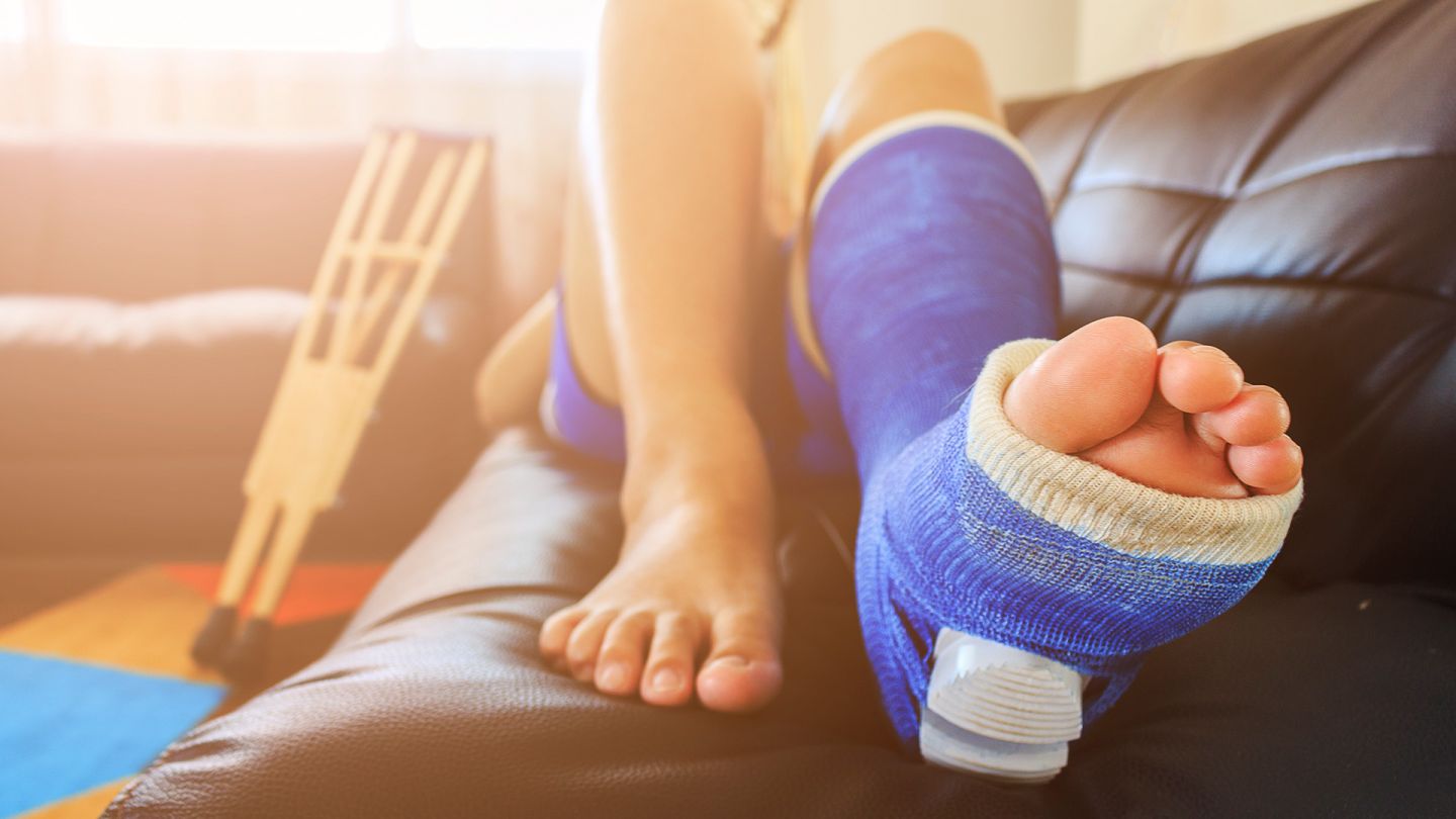 Sprunggelenkbruch (Quelle: Getty Images/Memorystockphoto) Sprunggelenkbruch: Ein sportlich gekleidete Frau liegt auf einer Couch, das linke Bein ist fast bis auf Kniehöhe eingegipst.