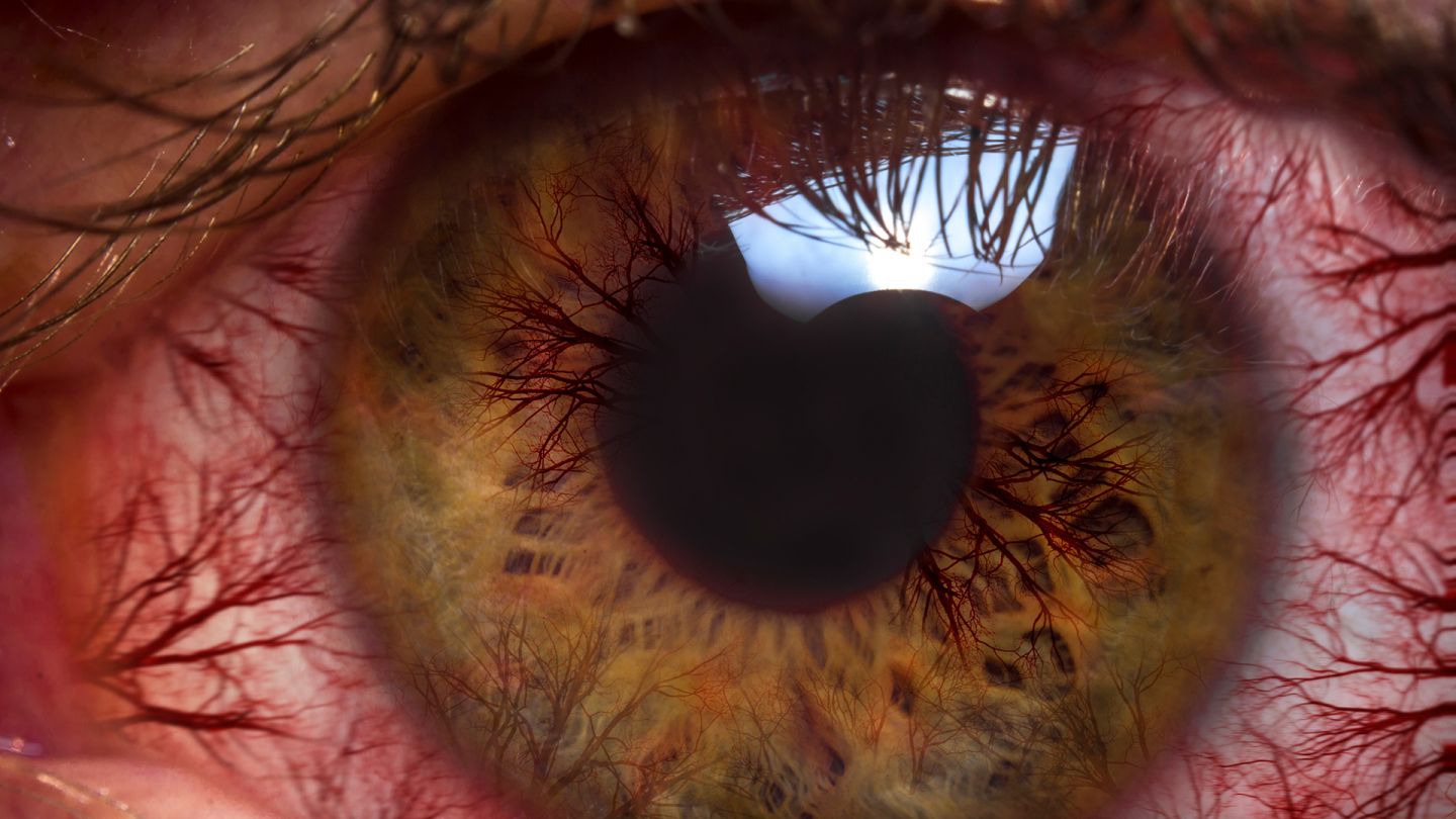 Menschliches Auge (Quelle: Getty Images/EzumeImages) Bindehautentzündung (Konjunktivitis): Nahaufnahme eines menschlichen Auges. Gut zu erkennen sind zahlreiche feine und rote Blutäderchen an der weißfarbenen Linse. Am oberen Rand der Pupille spiegelt sich Licht.