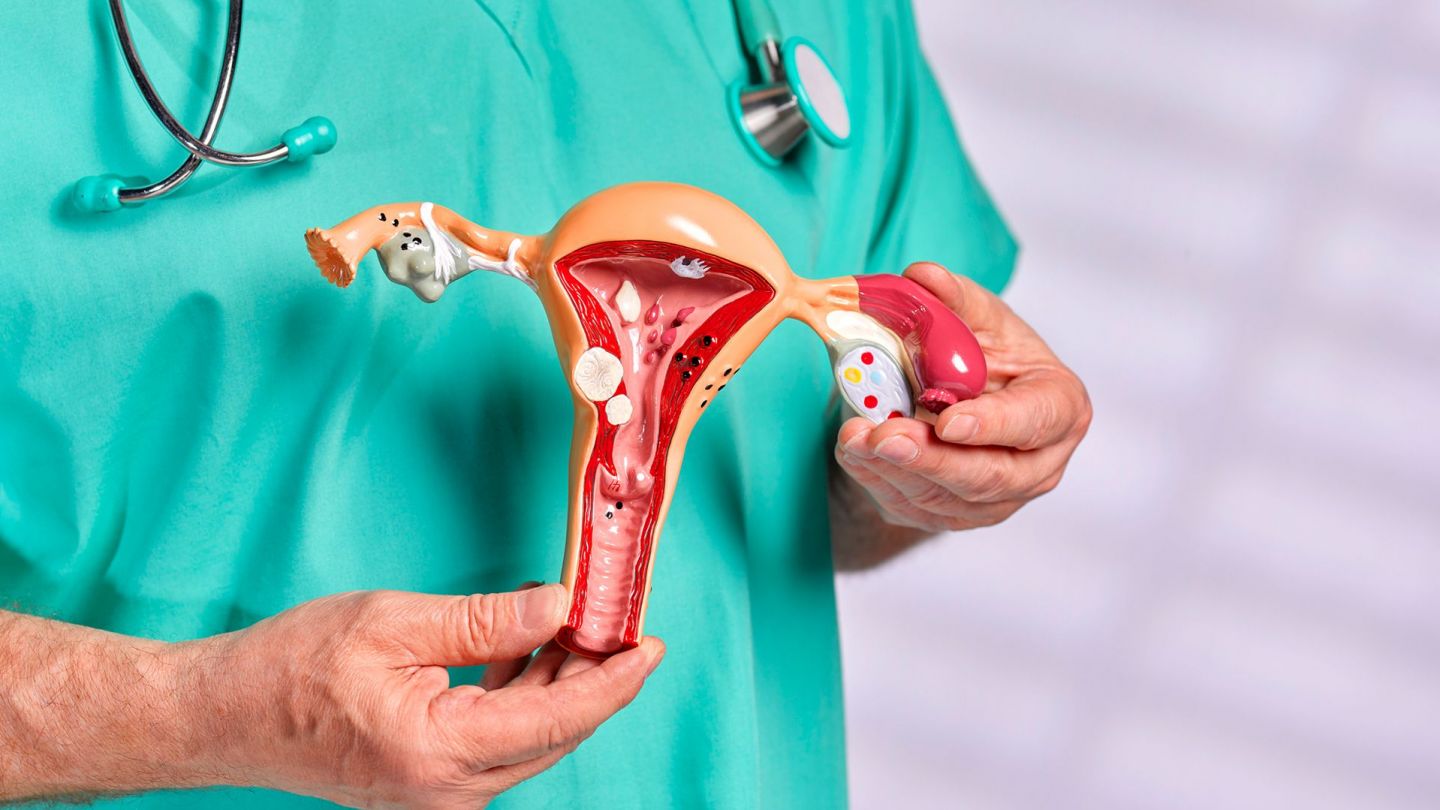 Modell der Gebärmutter (Quelle: Getty Images/Peter Dazeley) Gebärmutterkörperkrebs (Endometriumkarzinom): Ein Arzt hält das Modell einer Gebärmutter in beiden Händen.
