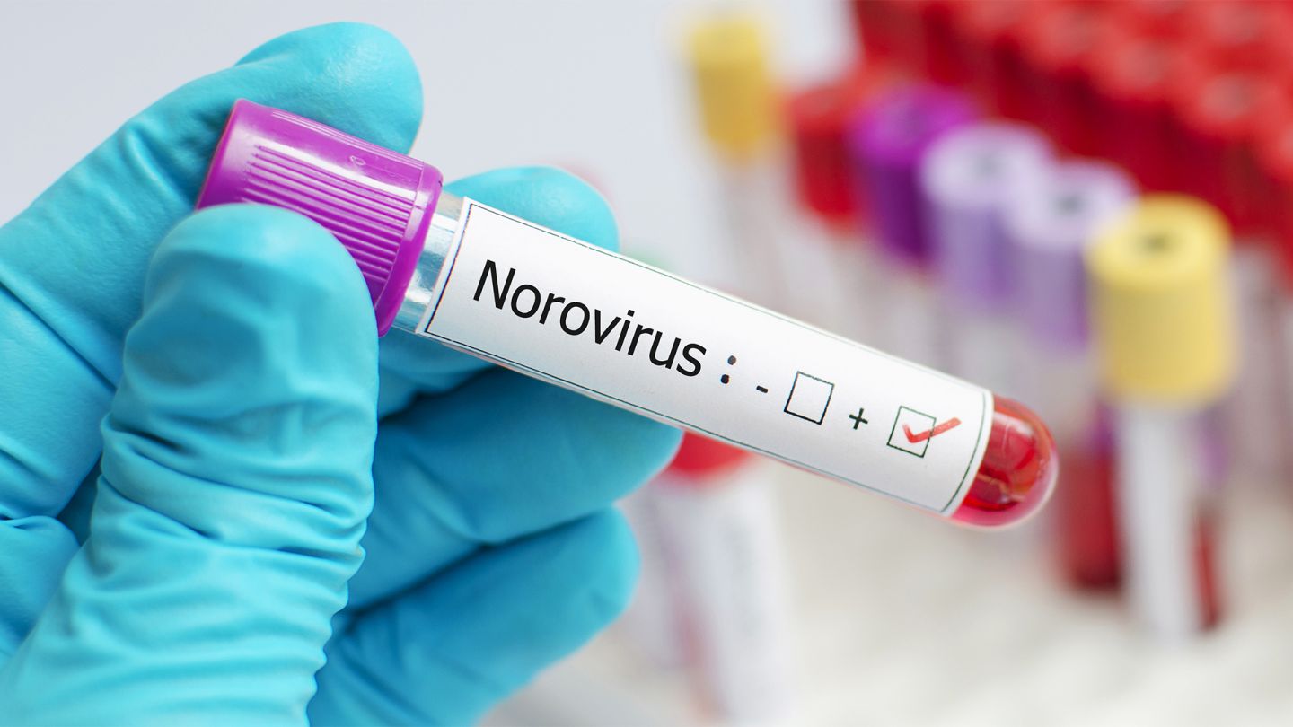 Norovirus (Quelle: GettyImages/jarun001) Norovirus: Blutteströhrchen mit einem Aufkleber eines positiven Norovirustests.