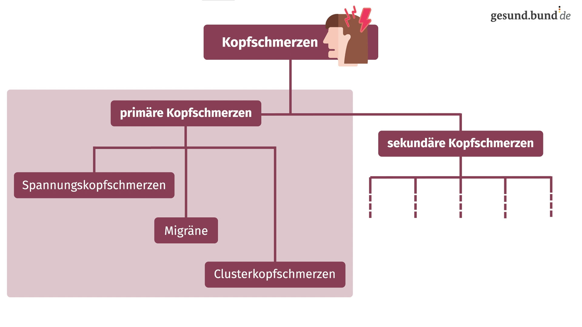 Cluster Kopfschmerzen Ursachen Vorbeugung Und Behandlung Gesund Bund De